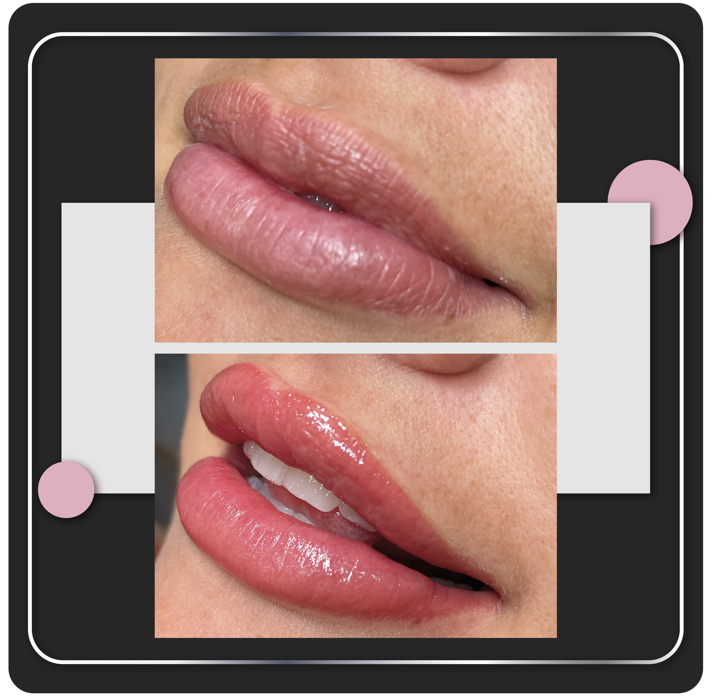 Lip Blush tratimiento en Aloha, Escazu, San Jose