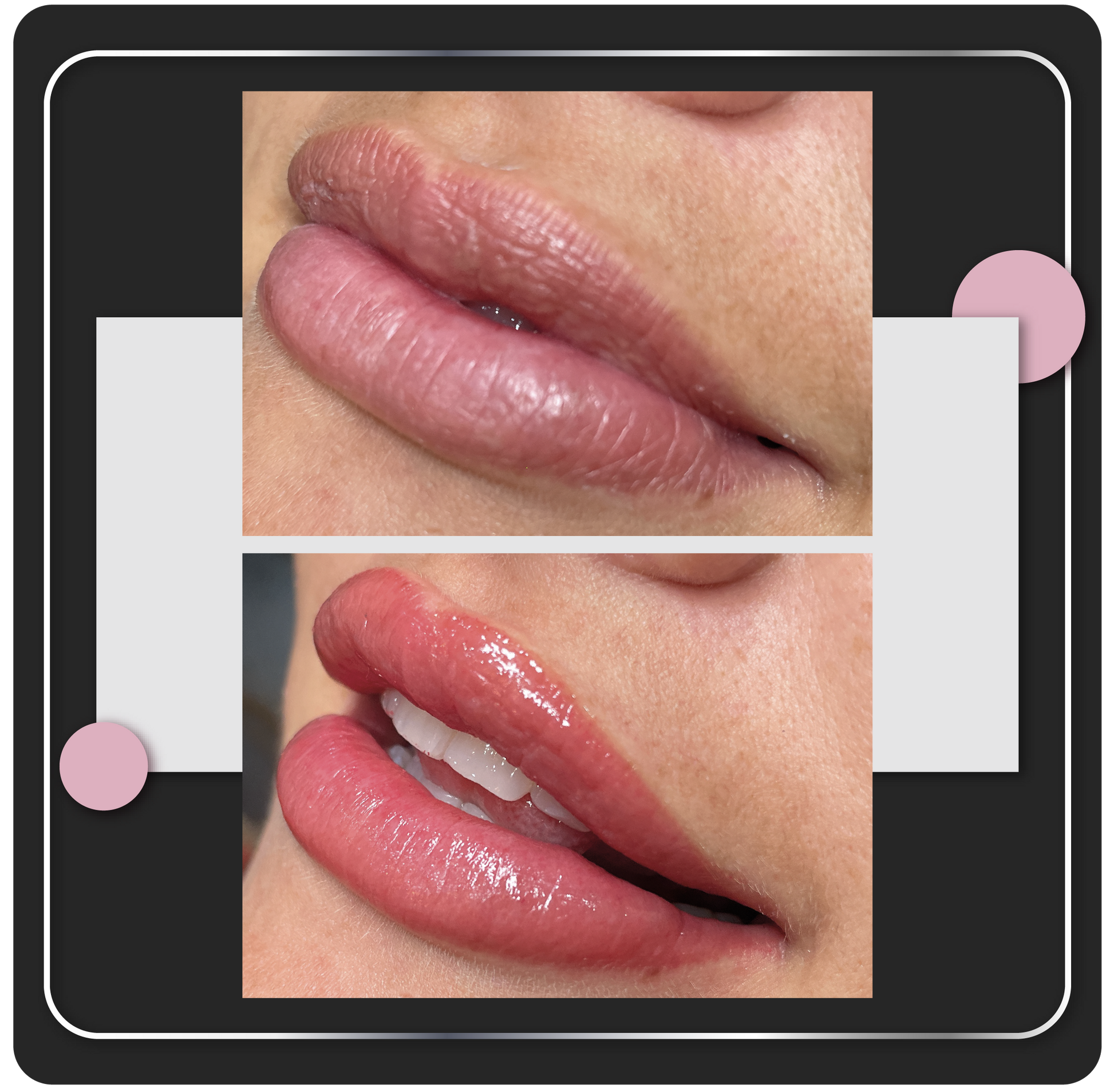 Lip Blush tratimiento en Aloha, Escazu, San Jose