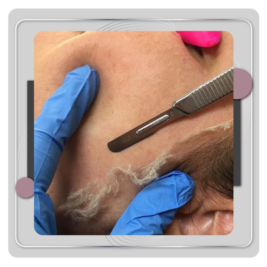 Dermaplaning